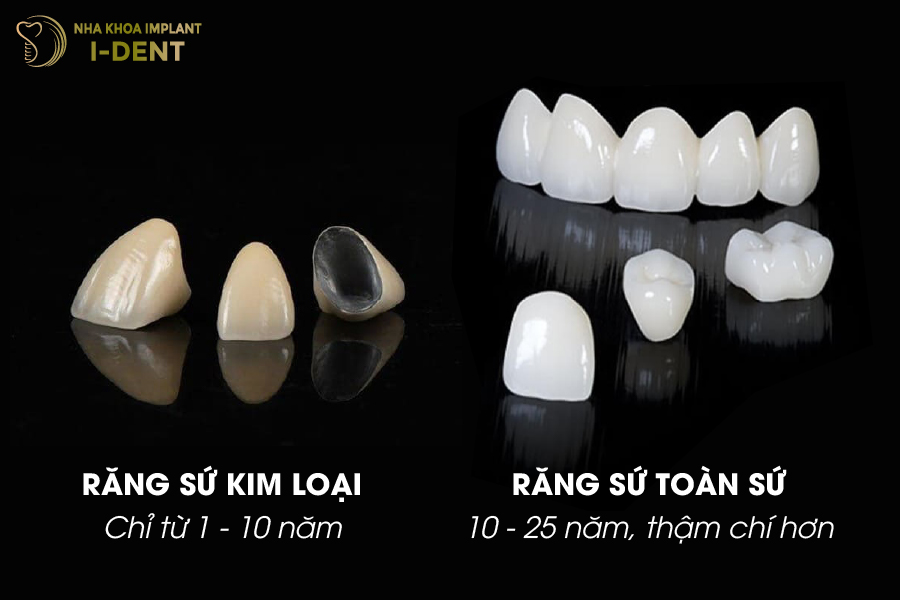Thời gian sử dụng của răng sứ kim loại và răng sứ toàn sứ Thời gian sử dụng của răng sứ kim loại và răng sứ toàn sứ