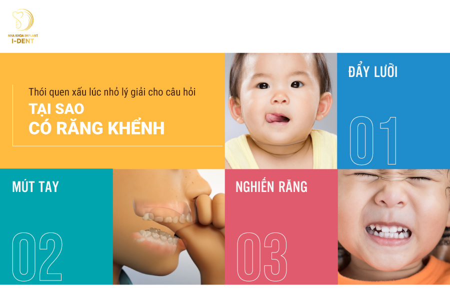 Tại sao lại mọc răng khểnh? Tại sao lại mọc răng khểnh?