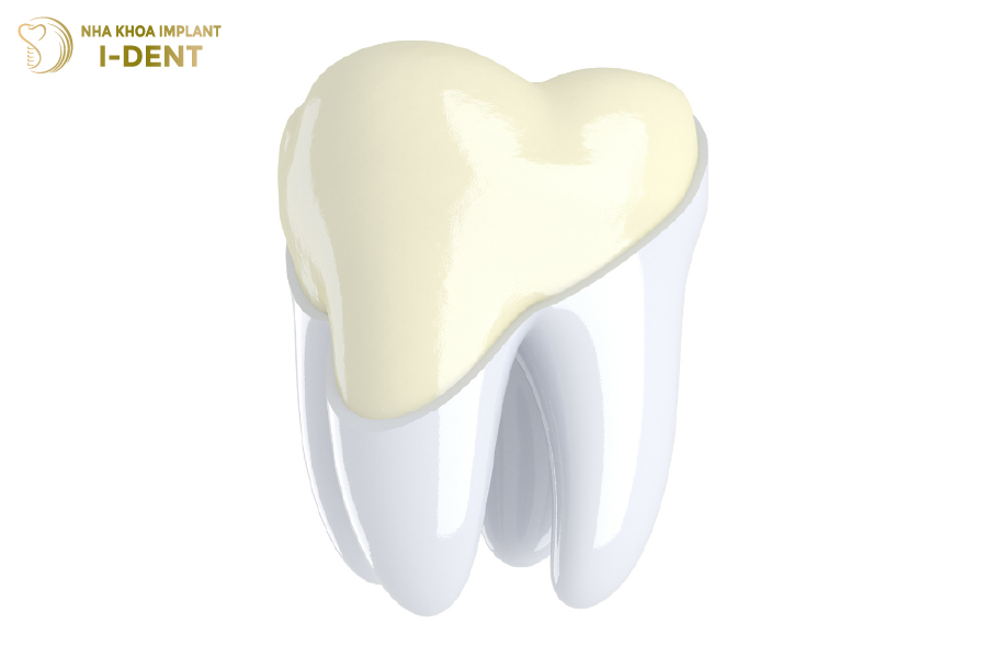 Tráng men răng sử dụng lớp men nhân tạo để củng cố răng chắc khỏe Tráng men răng sử dụng lớp men nhân tạo để củng cố răng chắc khỏe