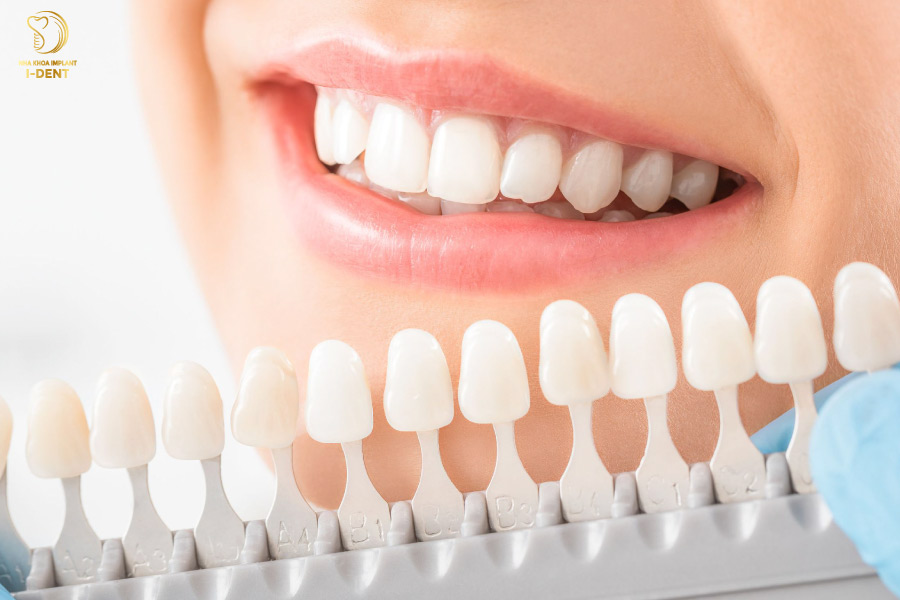 Tráng răng sứ không mài răng, đem đến hàm răng đều đặn, trắng sáng Tráng răng sứ không mài răng, đem đến hàm răng đều đặn, trắng sáng
