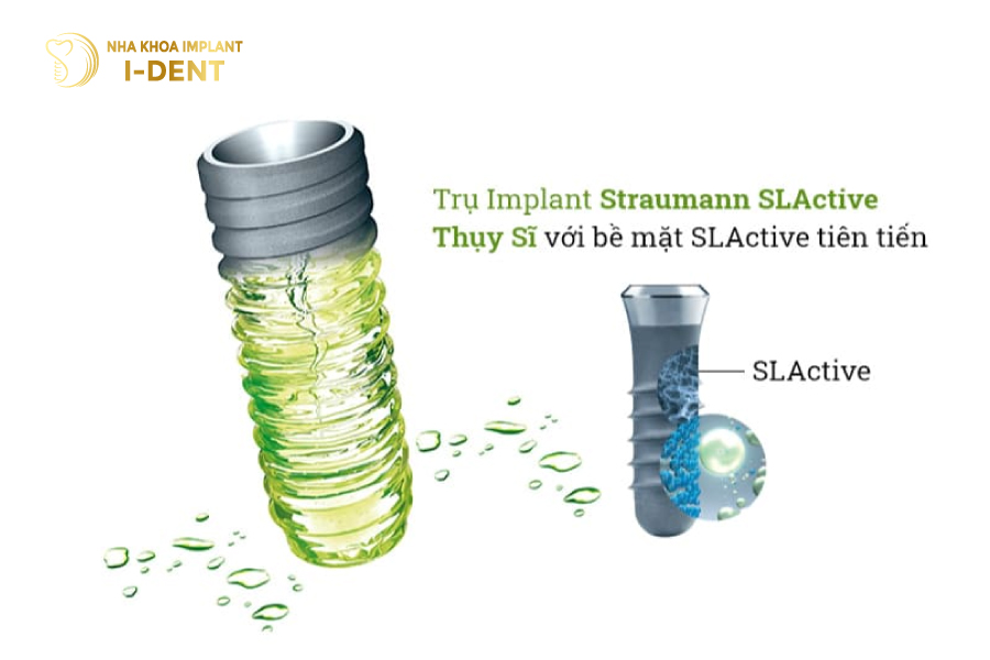 Trụ Implant Straumann có thời gian tích hợp xương nhanh nhất hiện nay thời gian trồng răng implant
