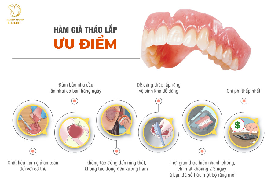 Ưu điểm của phương pháp làm răng giả tháo lắp Ưu điểm của phương pháp làm răng giả tháo lắp