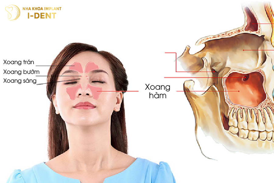 Vị trí của xoang hàm Vị trí của xoang hàm
