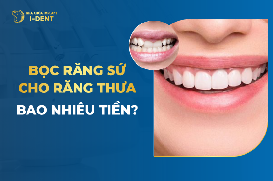 Bọc Răng Sứ Cho Răng Thưa Bao Nhiêu Tiền?