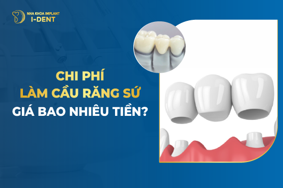 Chi Phí Làm Cầu Răng Sứ Giá Bao Nhiêu Tiền? Bảng Giá 2026