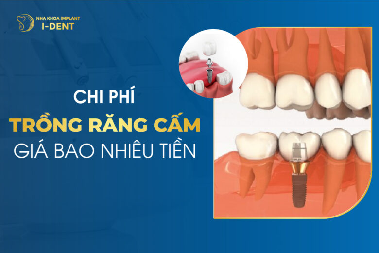 Trồng Răng Cấm Giá Bao Nhiêu? Chọn Phương Pháp Nào?
