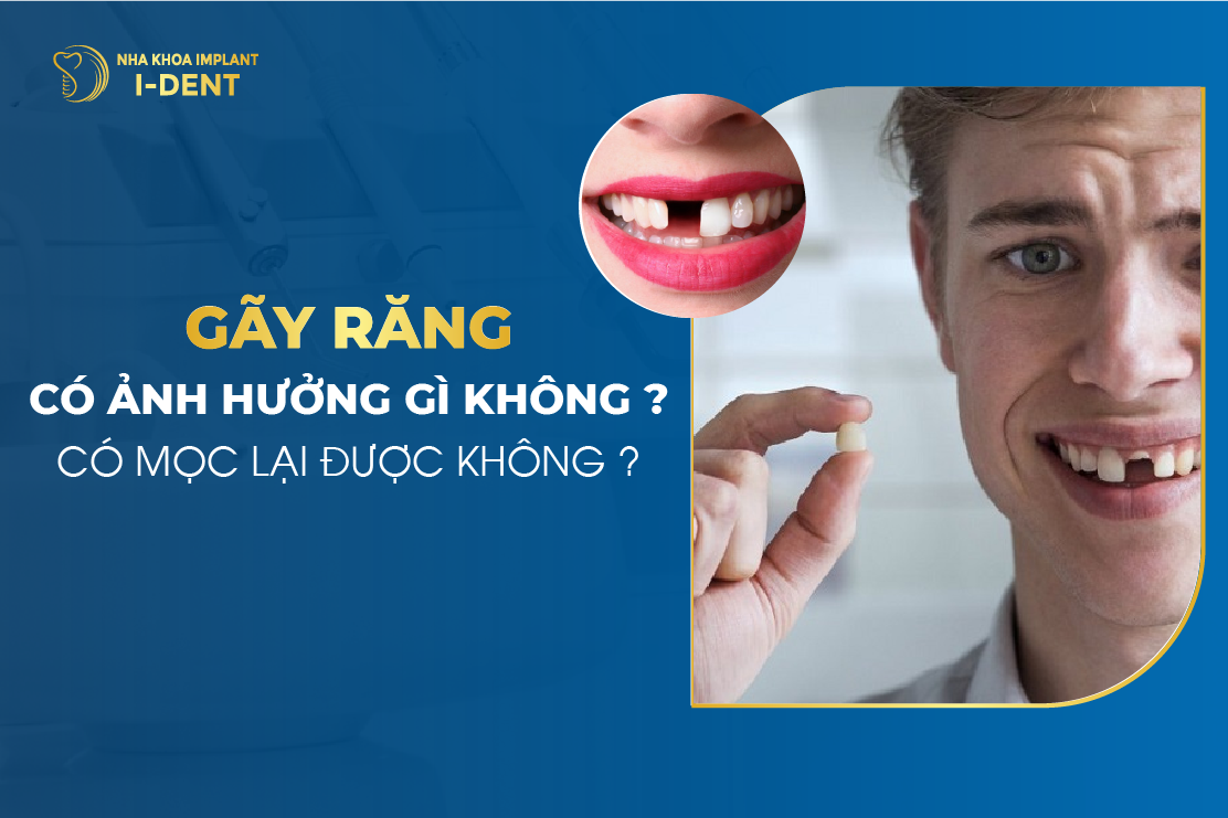 Gãy răng hàm có sao không? Phương pháp khắc phục