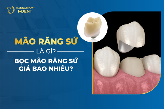 Mão Răng Sứ Là Gì? Bọc Mão Răng Sứ Giá Bao Nhiêu?