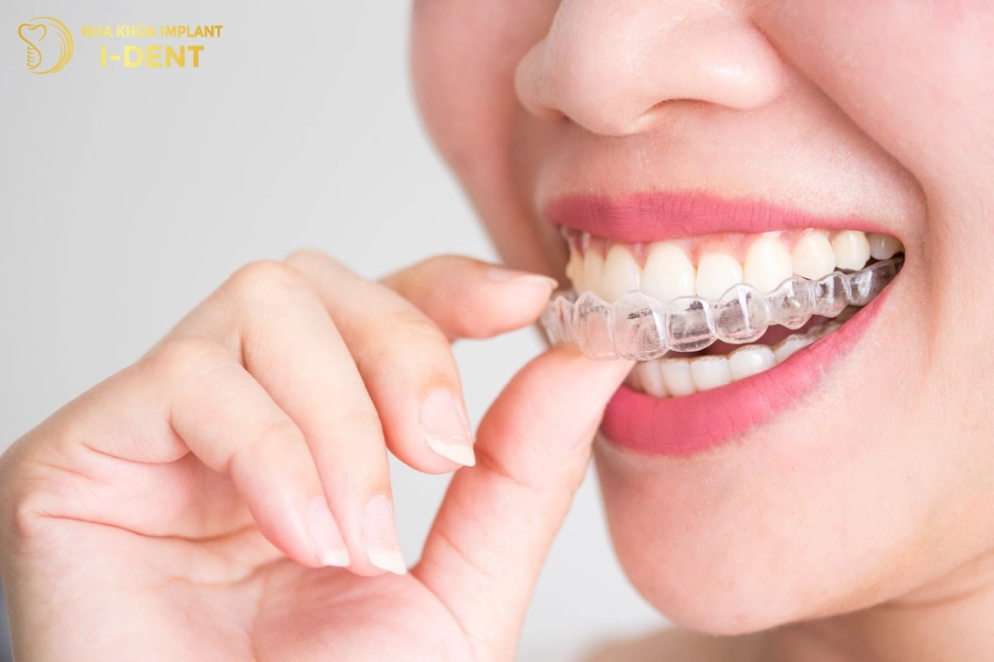 Nieng-rang-voi-khay-nieng-Invisalign-se-co-chi-phi-cao-nhat