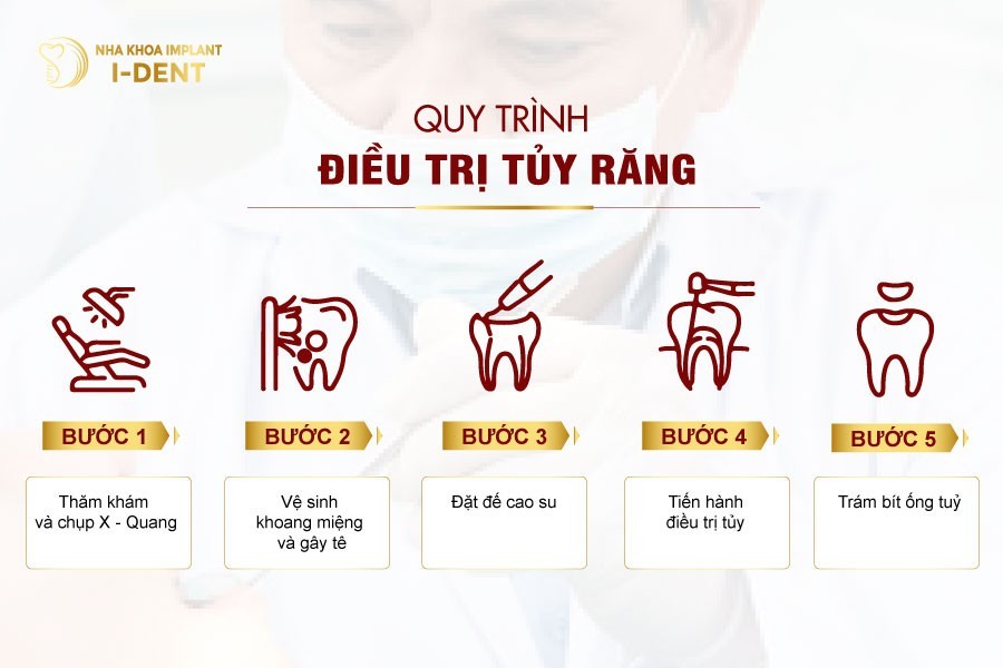 Quy-trinh-lay-tuy-rang-tai-nha-khoa-I-DENT
