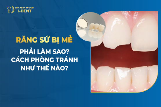 Răng Sứ Bị Mẻ Nguyên Nhân Do Đâu? Cách Khắc Phục