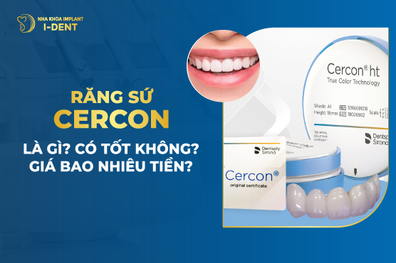 Răng Sứ Cercon Là Gì? Của Nước Nào? Giá Bao Nhiêu? Tốt Không?