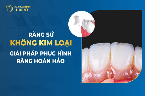 Răng Sứ Không Kim Loại – Giải Pháp Phục Hình Răng Hoàn Hảo