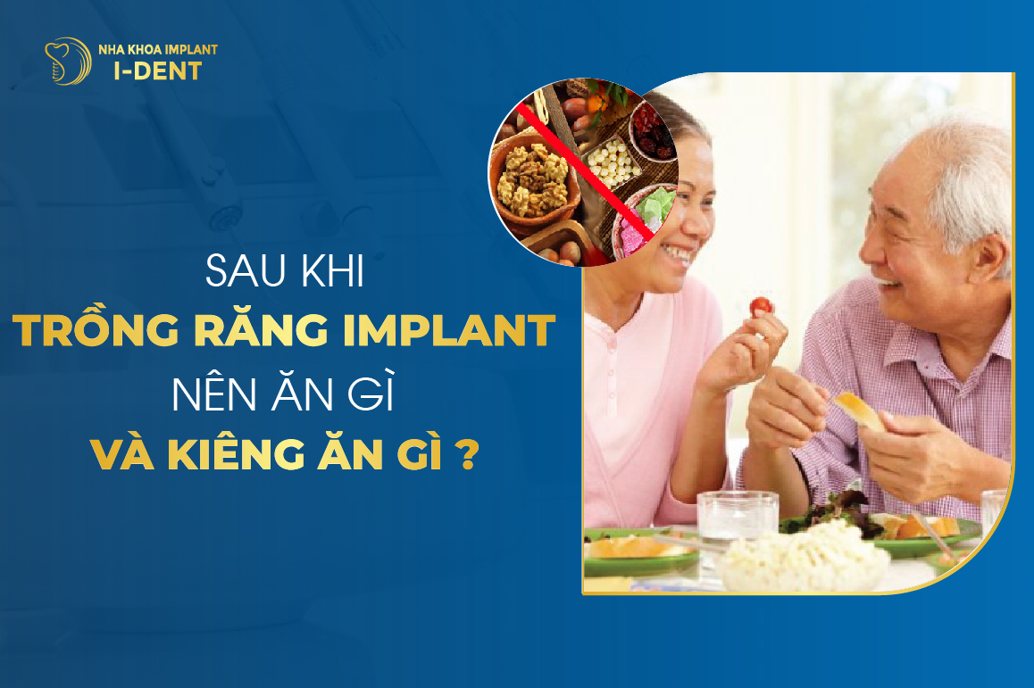 Sau Khi Trồng Răng Implant Nên Ăn Gì Và Kiêng Ăn Gì?