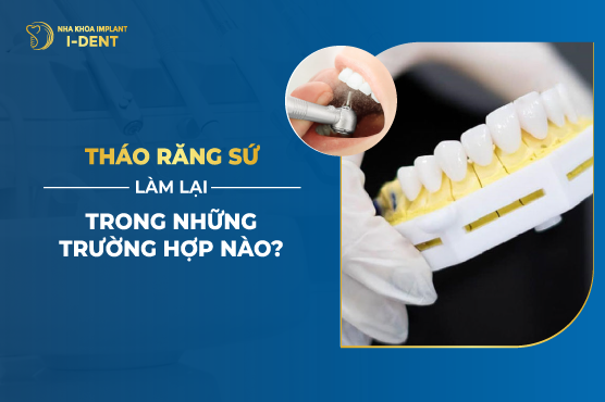 Bọc Răng Sứ Tháo Ra Có Lắp Lại Được Không? Quy Trình?