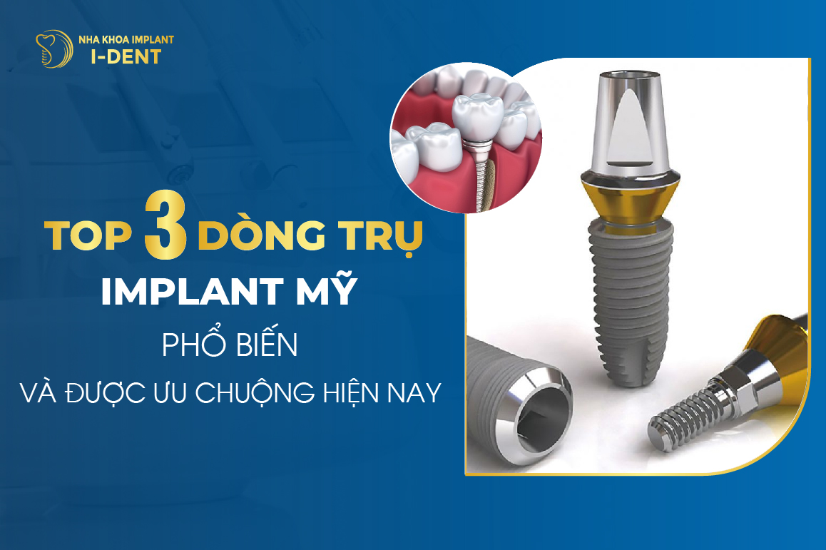 Top 3 Dòng Trụ Implant Mỹ Được Ưa Chuộng Nhất Hiện Nay