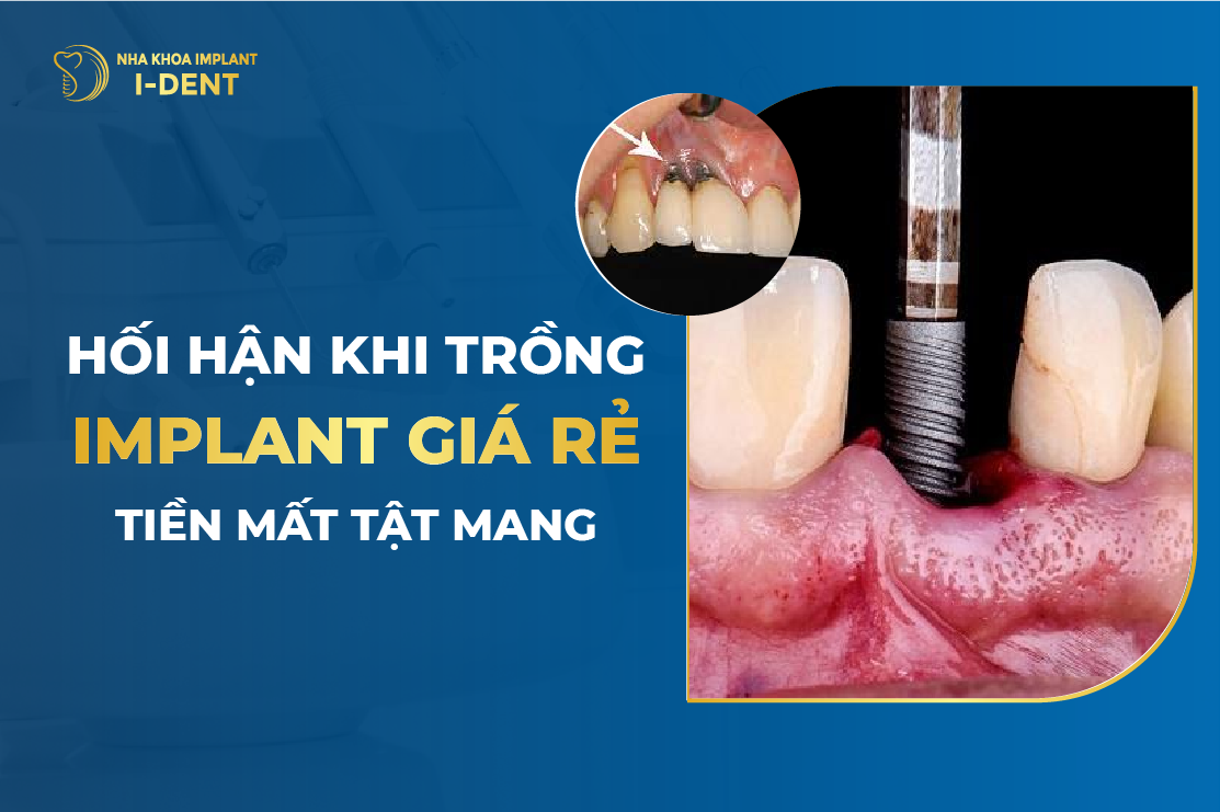 Trồng răng implant có nguy hiểm không? Tác hại? Có nên trồng?