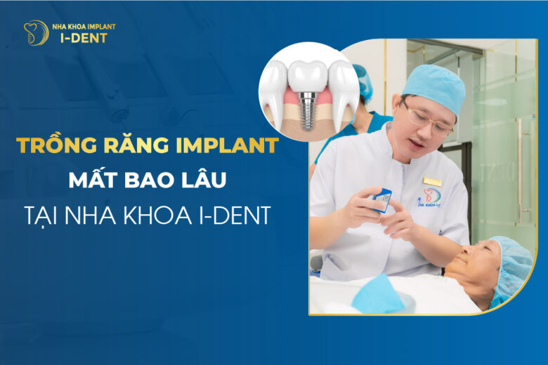 Trồng răng implant mất bao lâu? Quy trình chi tiết 3-6 tháng