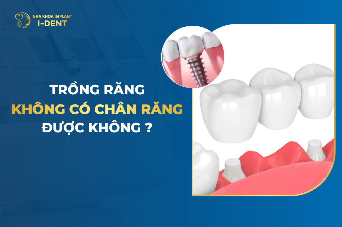 Trồng răng sứ không có chân răng được không? Giải đáp chi tiết