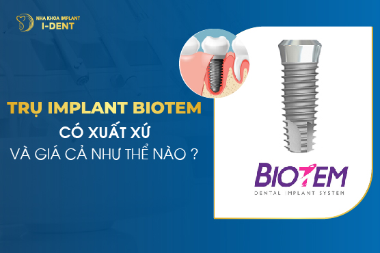 Trụ Implant Biotem Có Xuất Xứ Và Giá Cả Như Thế Nào?