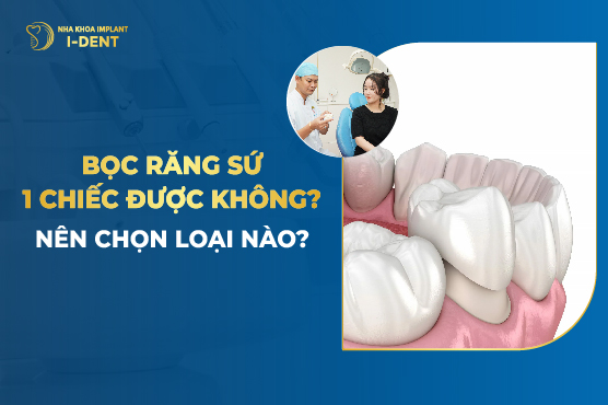 Bọc Răng Sứ 1 Chiếc Được Không? Nên Chọn Loại Nào?