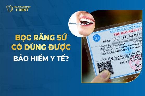 Bọc Răng Sứ Có Dùng Được Bảo Hiểm Y Tế?