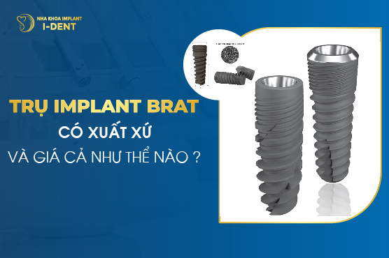Trụ Implant Brat Có Xuất Xứ Và Giá Cả Như thế Nào?