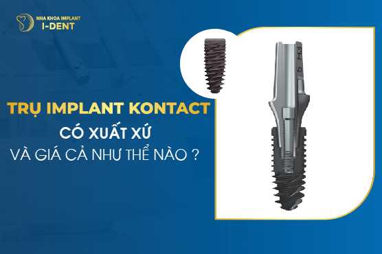 Trụ Implant Kontact Pháp: Xuất xứ, ưu điểm và giá cả