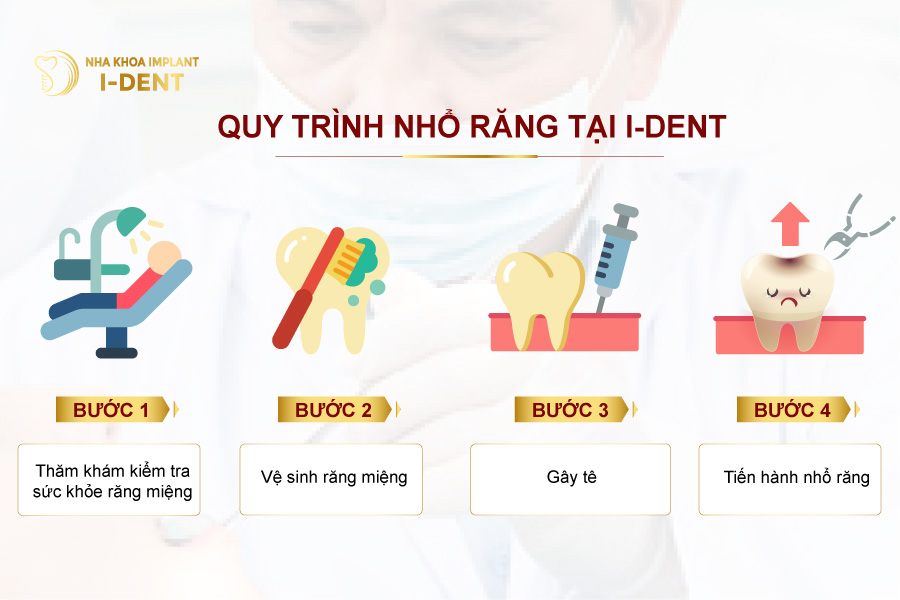 Các bước nhổ răng tại nha khoa I-DENT