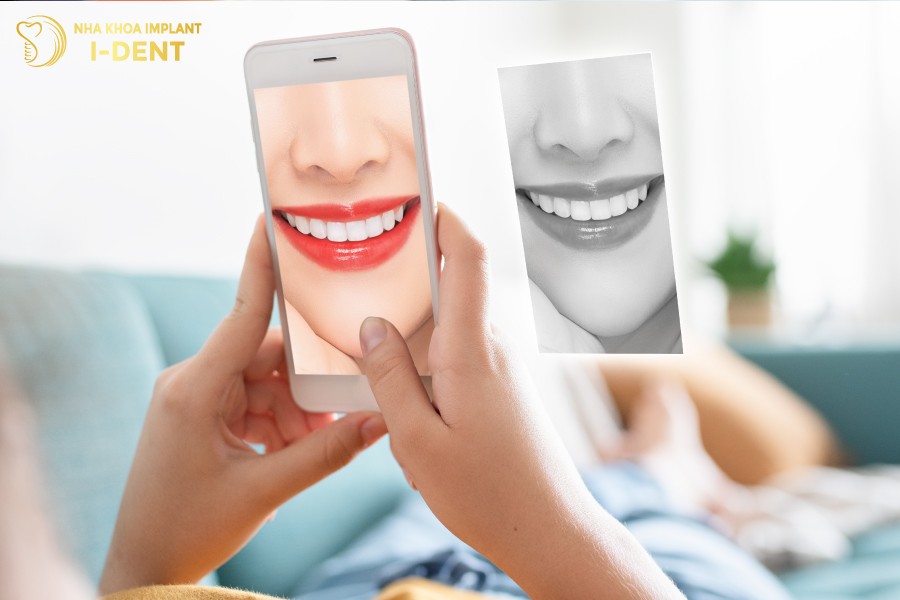 Dùng máy ảnh điện thoại để chụp hình và đánh giá màu răng Dùng máy ảnh điện thoại để chụp hình và đánh giá màu răng