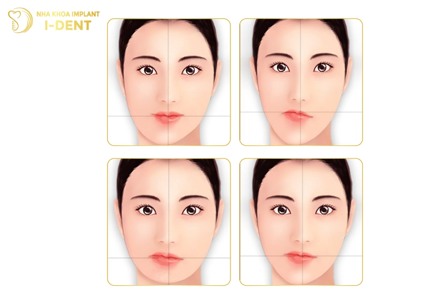 Một số gương mặt bị lệch