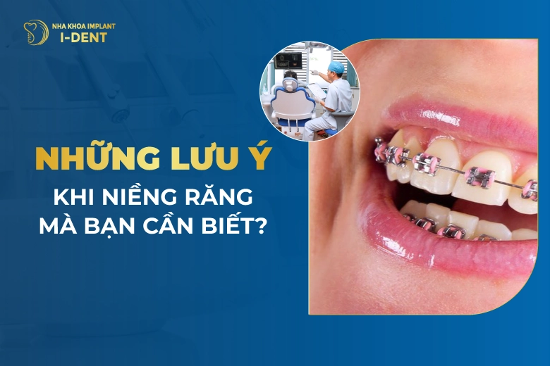 Lưu Ý Khi Niềng Răng: Trước, Trong Và Sau Niềng