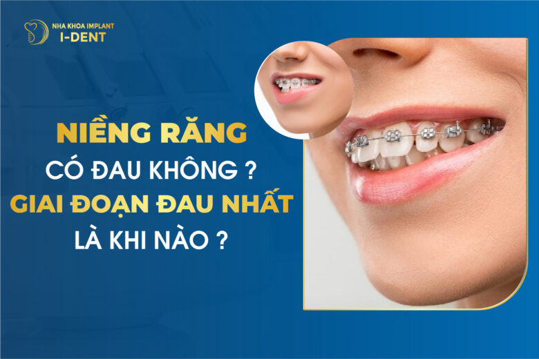 Niềng răng có đau không? 5 giai đoạn đau? Cách giảm đau