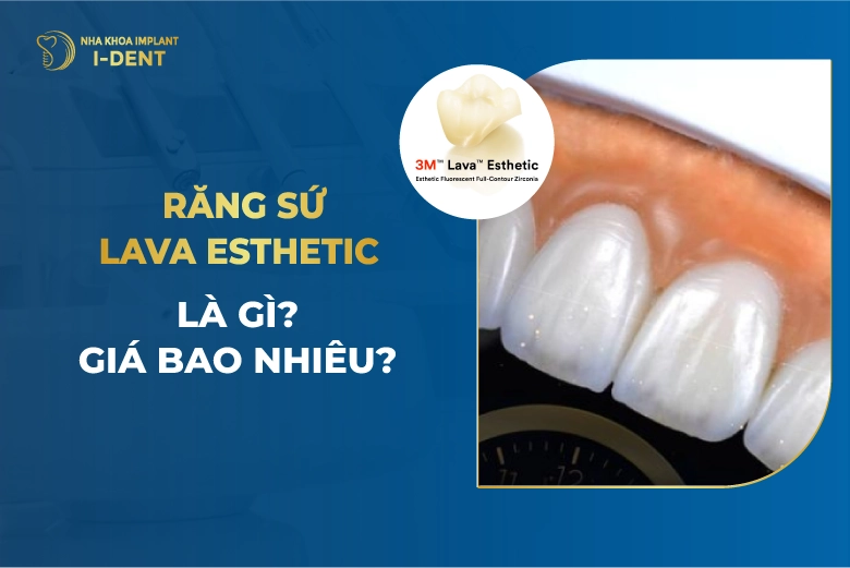Răng Sứ Lava Esthetic Là Gì? Giá Bao Nhiêu?