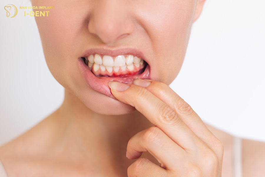 niềng răng có ảnh hưởng gì không