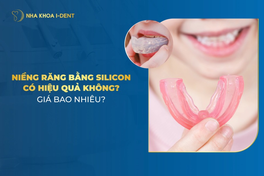 Niềng răng Silicon: Hiệu quả và giá niềng cho trẻ