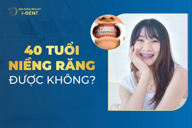 40 tuổi niềng răng được không? Bao nhiêu tiền?