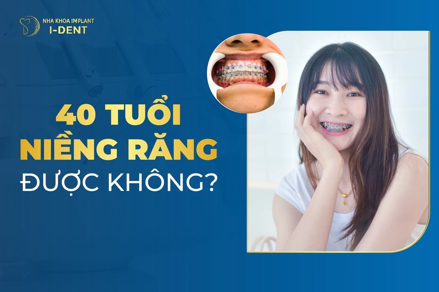 40 tuổi niềng răng được không? Bao nhiêu tiền?