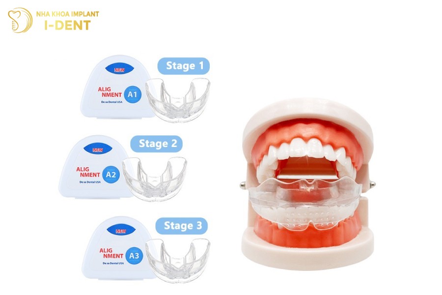 niềng răng trong suốt tại nhà
