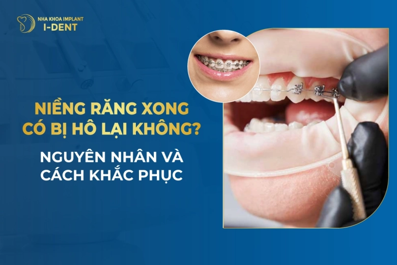Niềng răng xong bị hô do đâu? Cách khắc phục