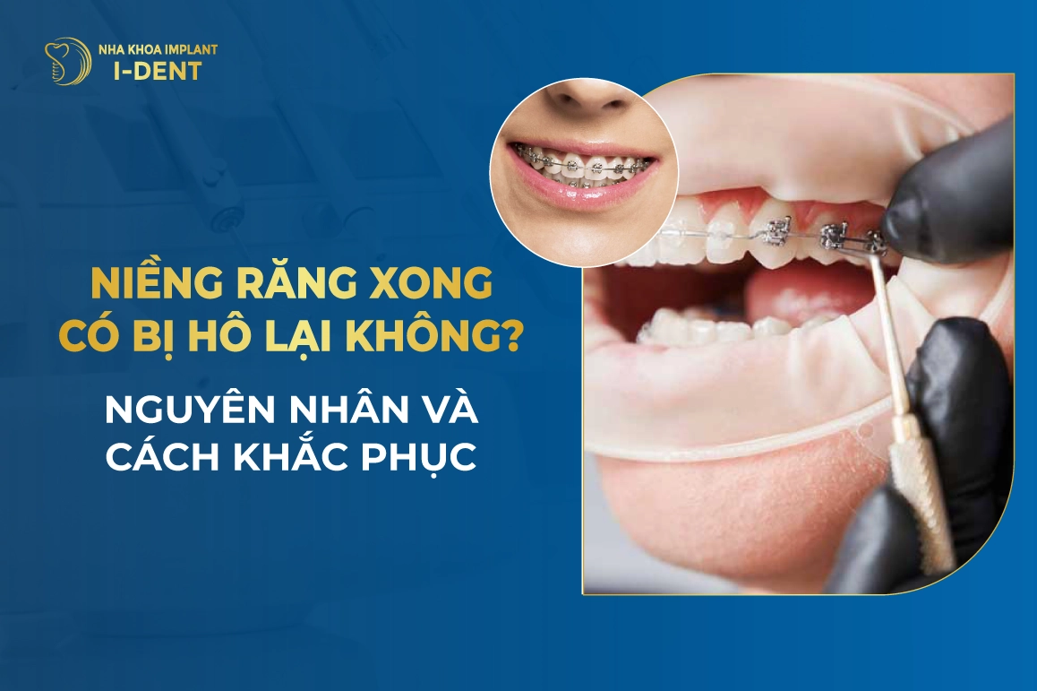 Niềng răng xong bị hô do đâu? Cách khắc phục