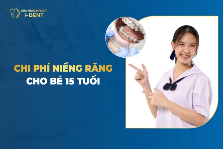 15 Tuổi Niềng Răng Bao Nhiêu Tiền? Thời Gian Bao Lâu?