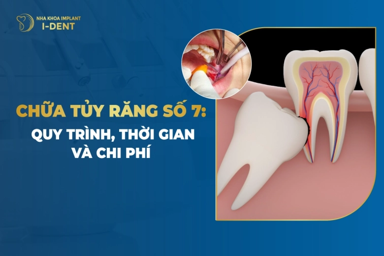 Chữa Tủy Răng Số 7: Quy Trình, Thời Gian Và Chi Phí