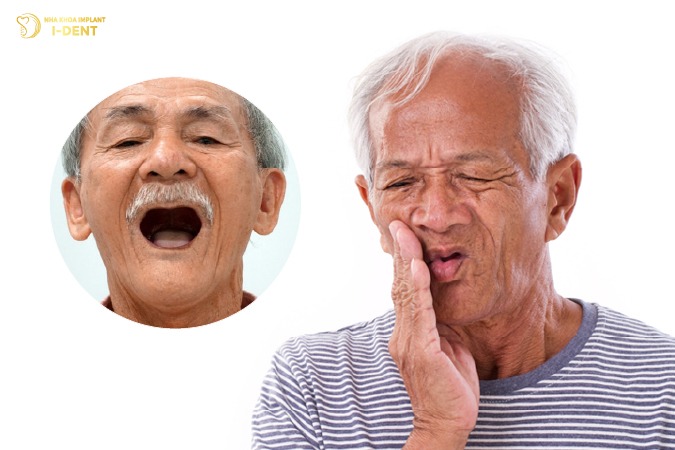Mất răng toàn hàm ở người cao tuổi mất răng toàn hàm