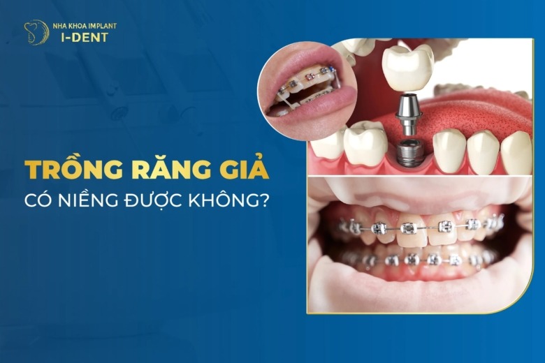 Răng Giả Có Niềng Răng Được Không?