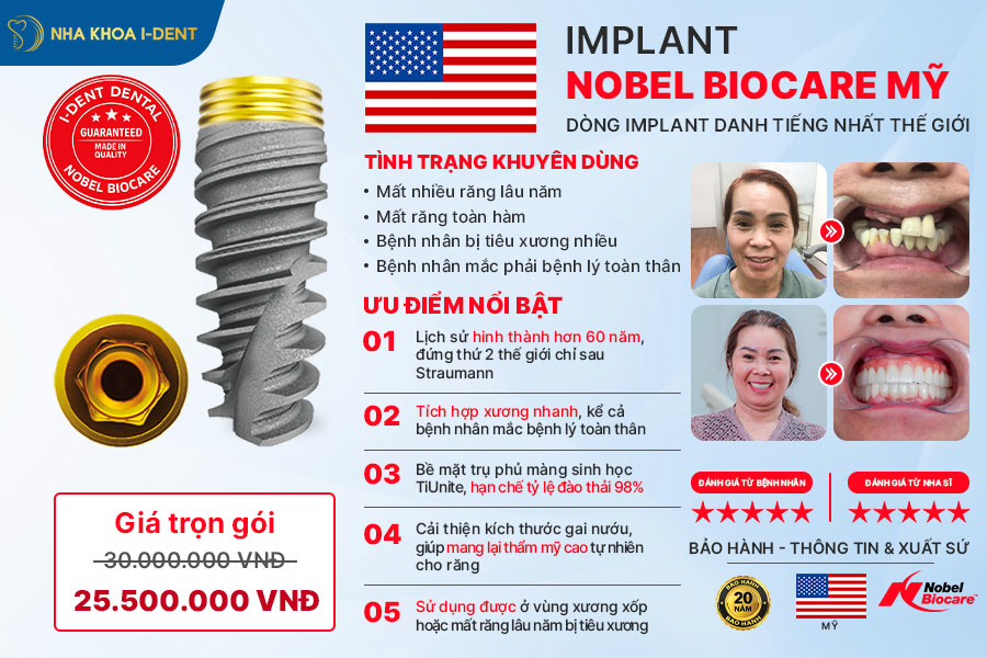 trụ implant mỹ tốt không