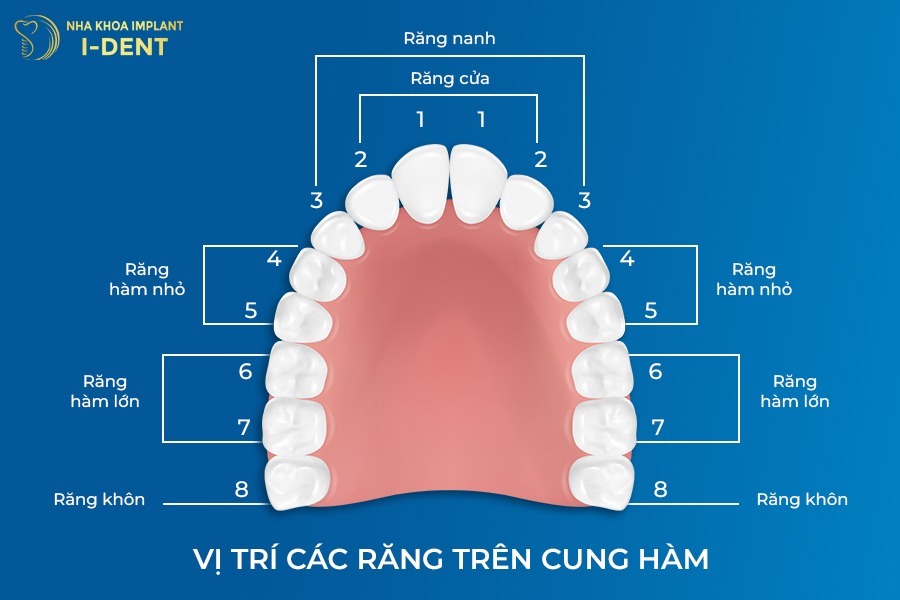 Hình ảnh vị trí các răng trên cung hàm mất răng hàm có bị hóp má không