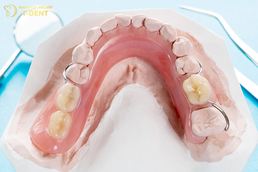 Làm răng giả tháo lắp trồng răng hàm bị sâu