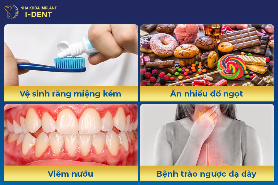 Những nguyên nhân làm răng hàm bị sâu trồng răng hàm bị sâu