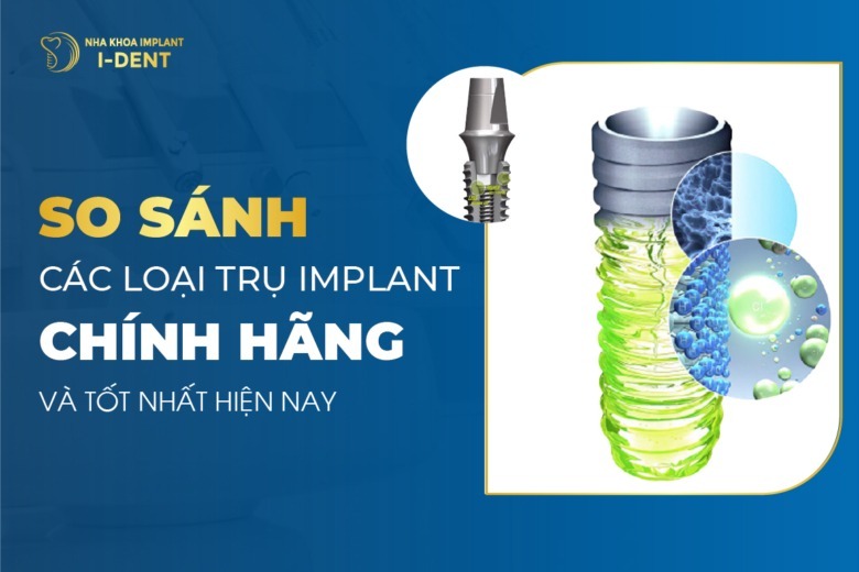 Trồng răng implant loại nào tốt? So sánh các loại trụ implant phổ biến